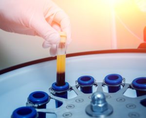 Platelet-rich plasma preparation - Gloved hand placing a vial of blood in a centrifuge machine