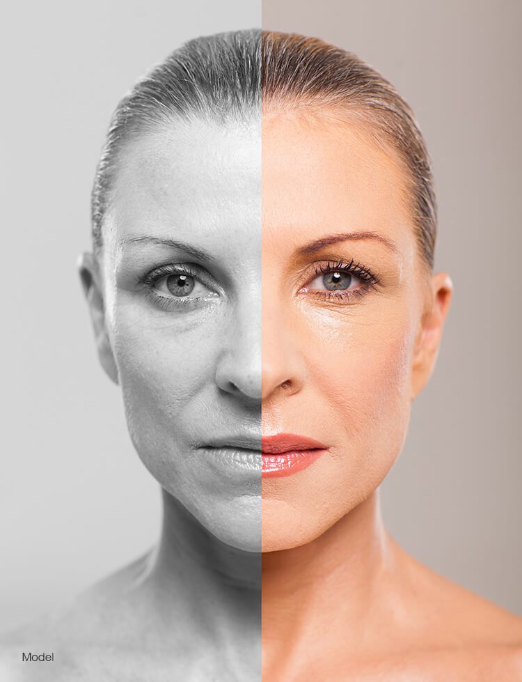 Portrait of a woman demonstrating potential results that can be achieved with facial plastic surgery and non-surgical cosmetic treatments.