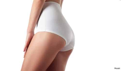 The Brazilian Butt Lift naturally restores volume and lift to the buttocks.