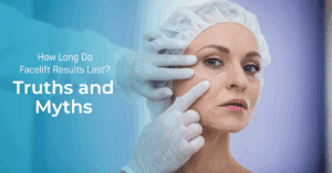 Facelift Results