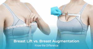 Breast Lift vs. Breast Augmentation