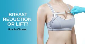 Breast Reduction or Lift