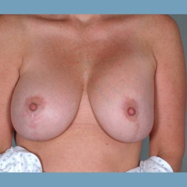 After Image