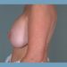 After Image