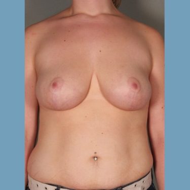 After Image