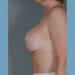 After Image