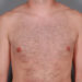 After Image