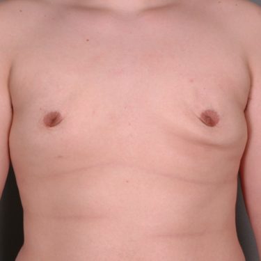 After Image
