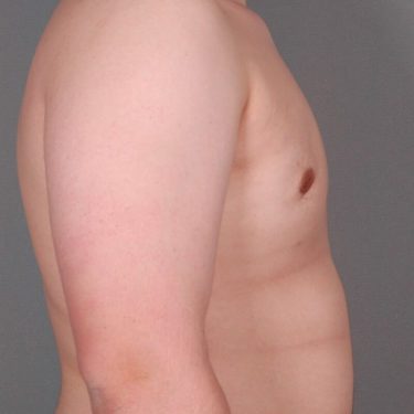 After Image