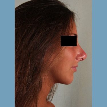 After Image
