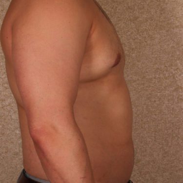 After Image