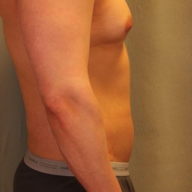 Before Image