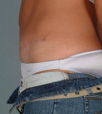 After Image