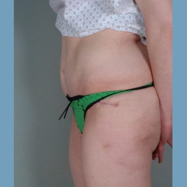 After Image