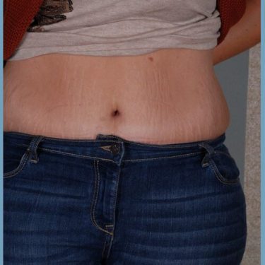 After Image