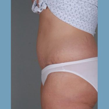 After Image