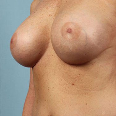 After Image