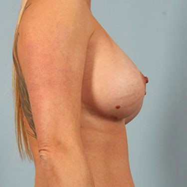 After Image