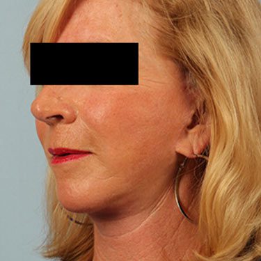After Image