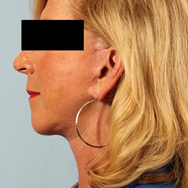 After Image