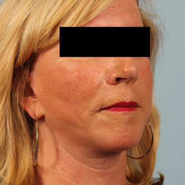 After Image