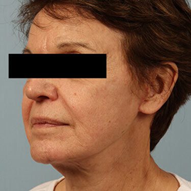 After Image