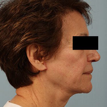 After Image