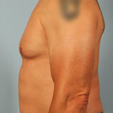 After Image