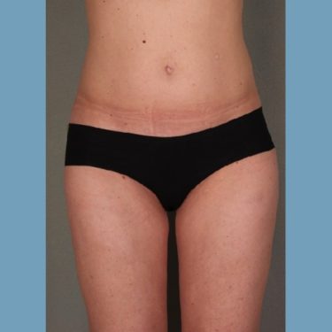 After Image