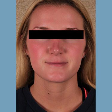 After Image