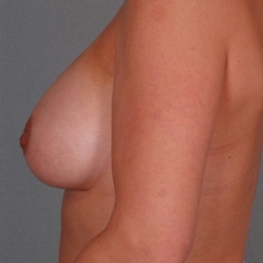 After Image