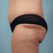 After Image