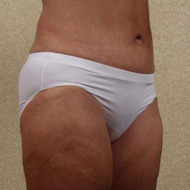 After Image